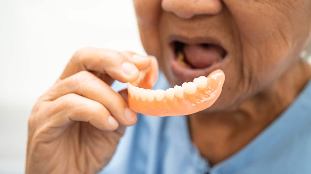 How to Prevent or Deal With Bone Loss From Denture Wear