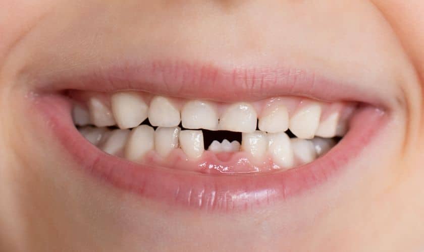Baby Teething Tips During Holiday Season