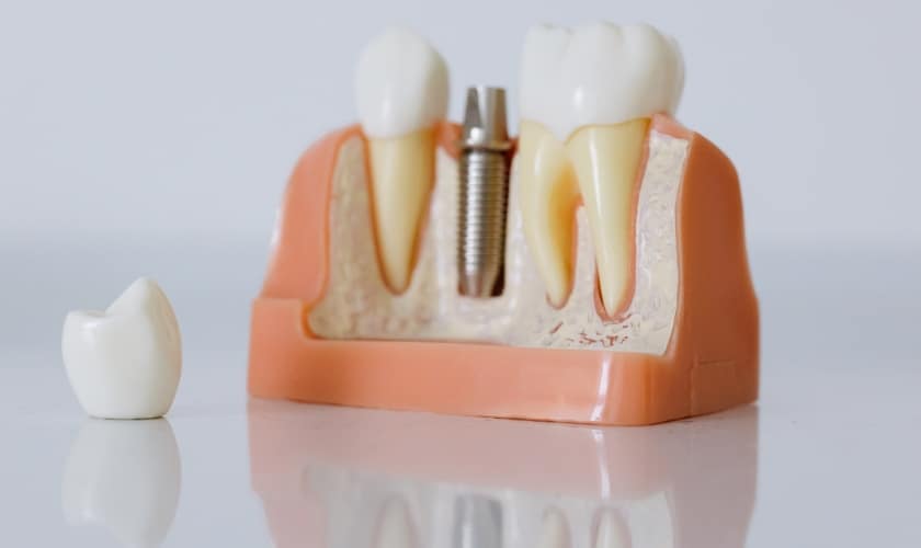 By In Smyle Dental - Lakeview Roscoe Village