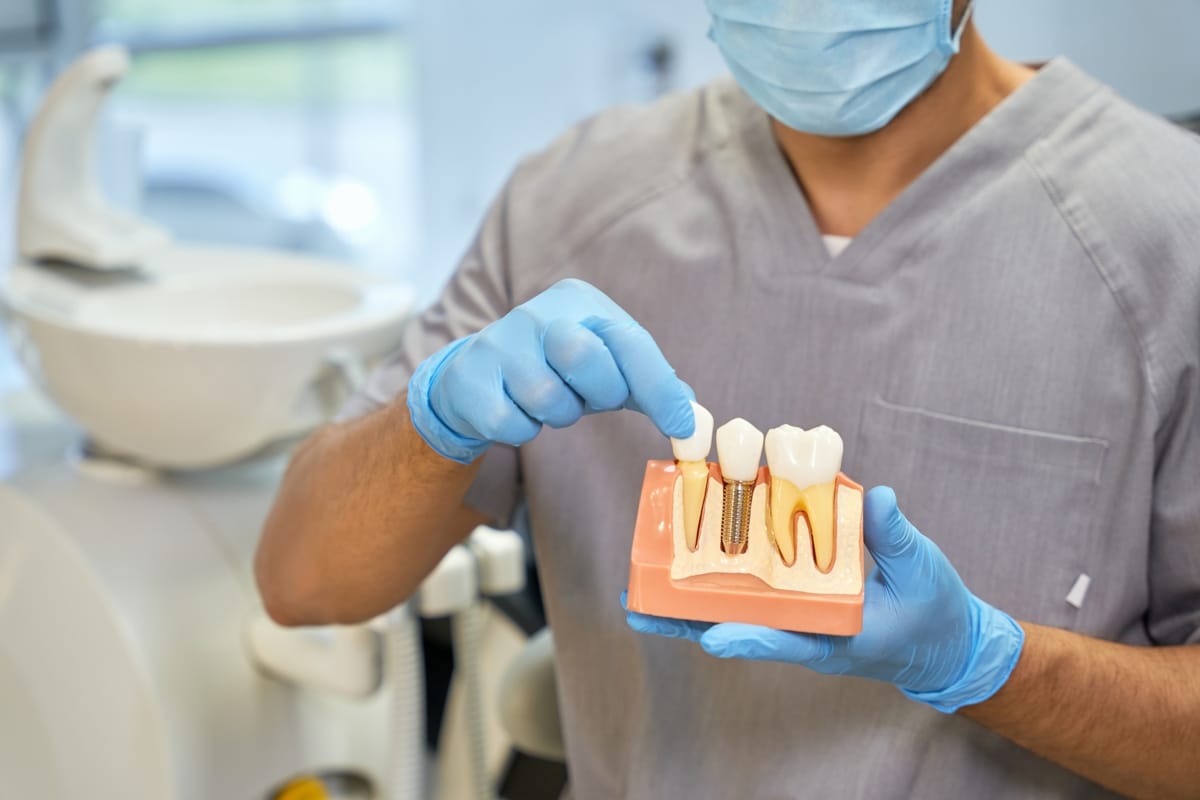 Essential Oral Hygiene for Long-Lasting Dental Implants