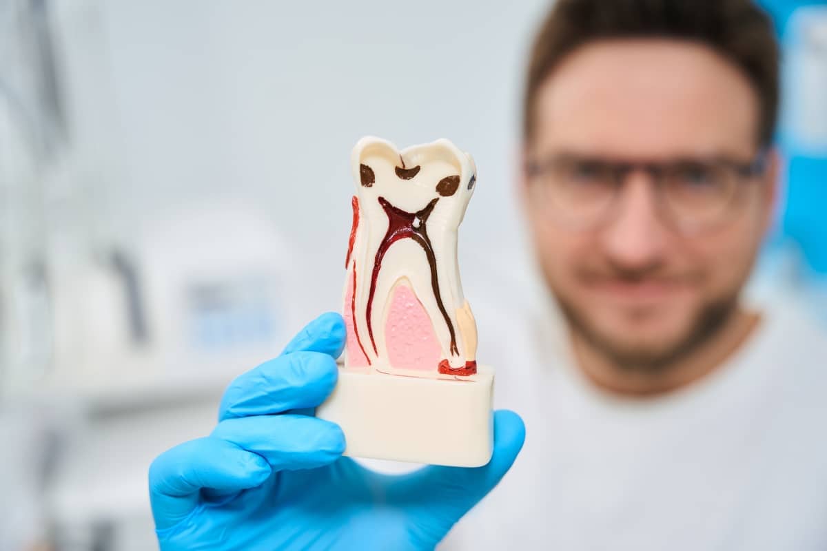 Why Non-Surgical Root Canals Are Gaining Popularity