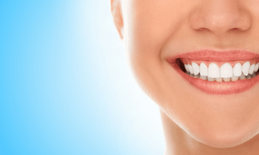 Top 5 Benefits Of Teeth Whitening