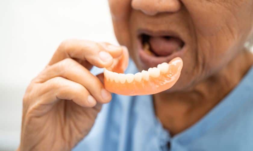Differences between Full and Partial Dentures Explained