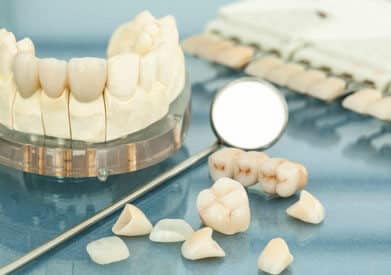 Dental Crowns Treatment in Chicago - InSmyle Dental - Dentist Chicago