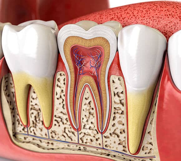 Root Canal Therapy in Chicago - InSmyle Dental - Dentist Chicago