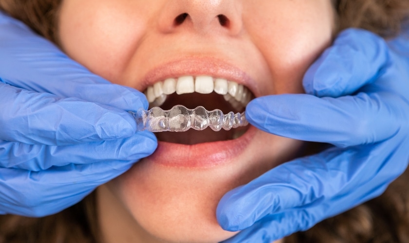 How Eco-Friendly Materials are Transforming Invisalign Treatment - InSmyle Dental - Dentist Chicago