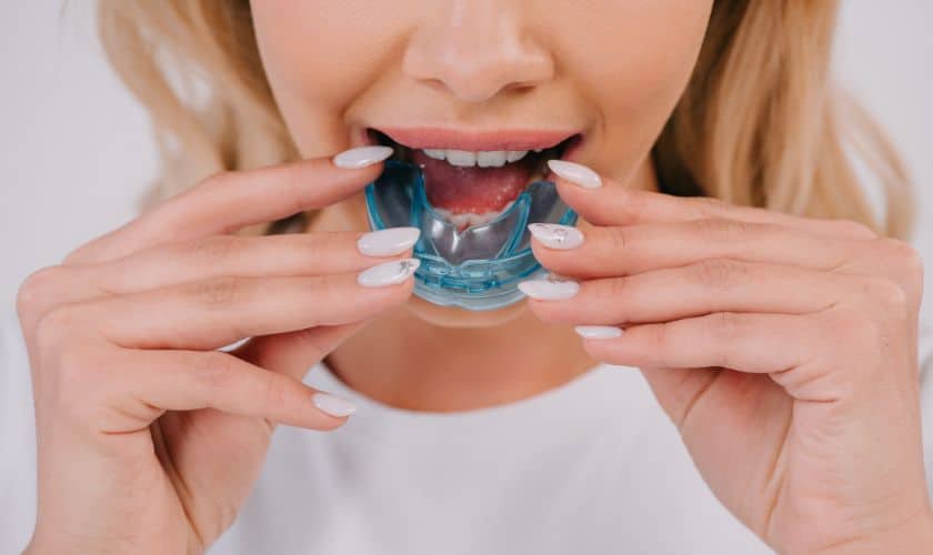Wearing Mouth Nightguards - InSmyle Dental - Dentist Chicago