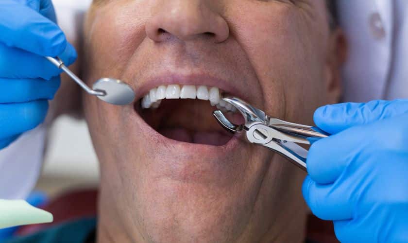 which tooth extraction is the most painful
