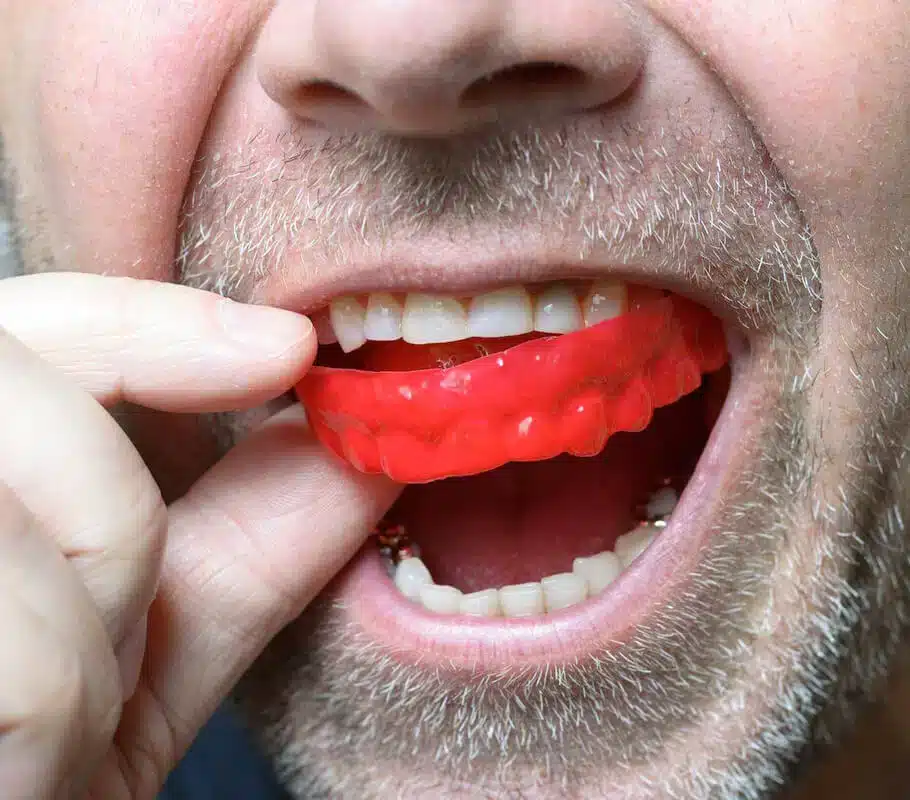 bruxism treatments chicago