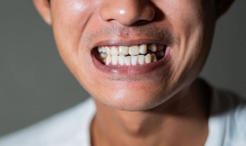 the connection between stress and bruxism in chicago