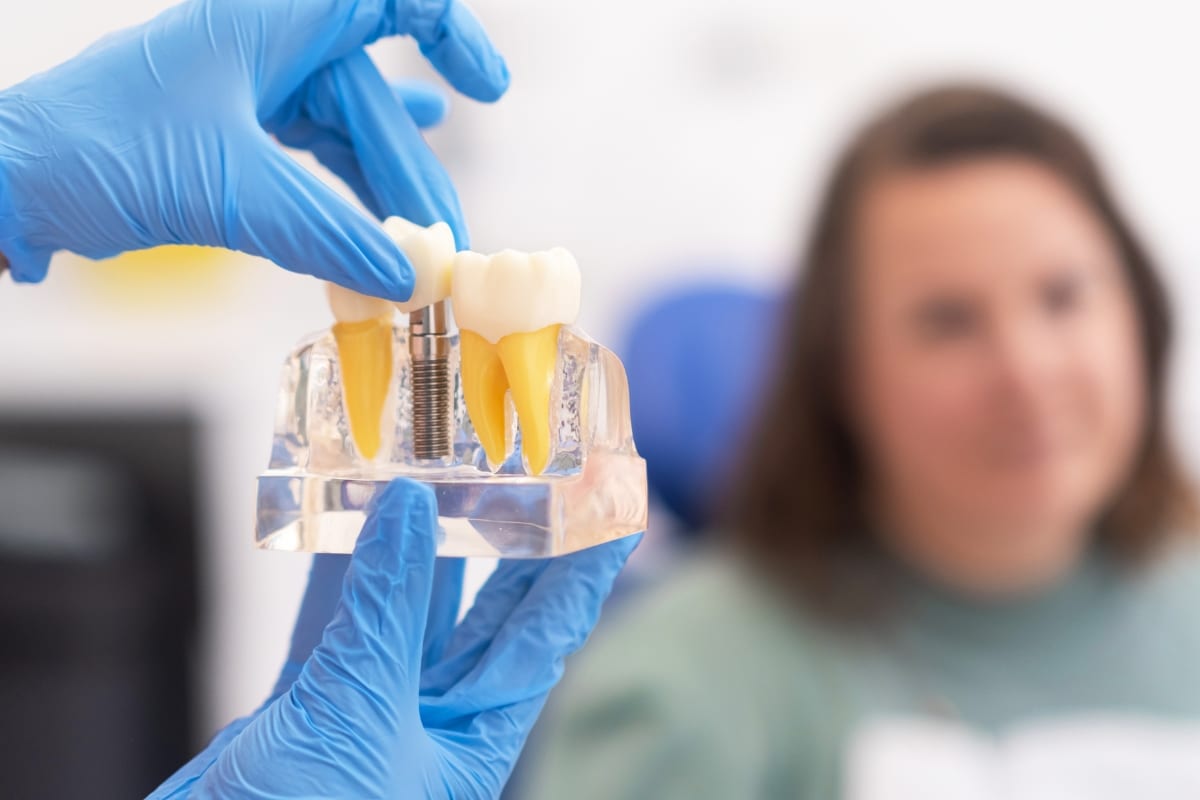 Dental-Implants-in-Lakeview-and-Roscoe-Village